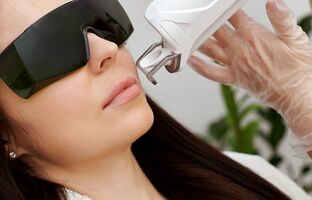 Лазерна епіляція обличчя Олександритовим лазером у Рівному, Алхімія Краси