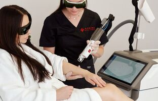 Лазерна епіляція рук Олександритовим лазером у Рівному, Алхімія Краси