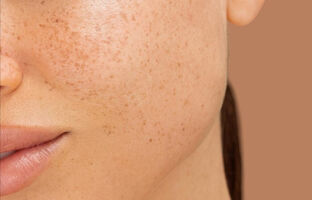 Лазерна косметологія в Рівному, Алхімія Краси