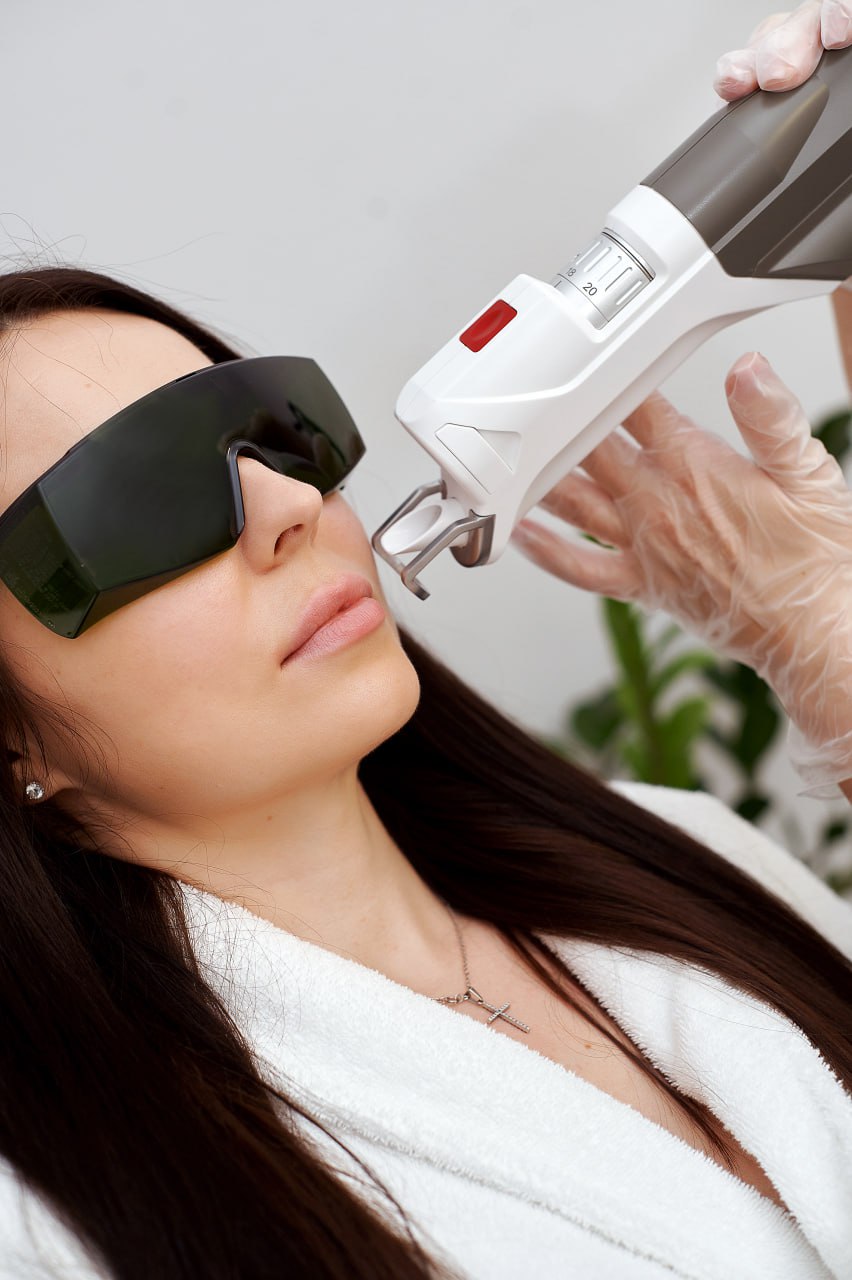 лазерна епіляція обличчя у Рівному